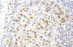 SAFB Antibody, Novus Biologicals 0.1 mL | Buy Online | Novus Biologicals | Fisher Scientific